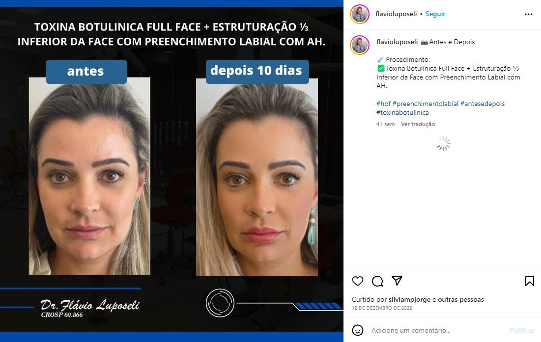 Os Melhores Especialistas em Harmonização Facial de 2022